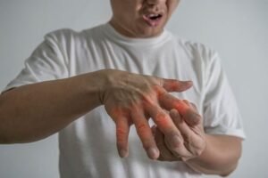Rheumatoid arthritis