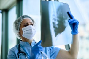 Tuberculosis Treatment