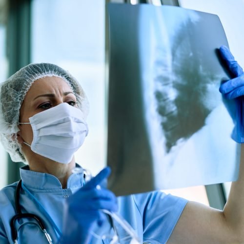 Female radiologist analyzing chest X-ray of an patient at medical clinic during coronavirus epidemic.